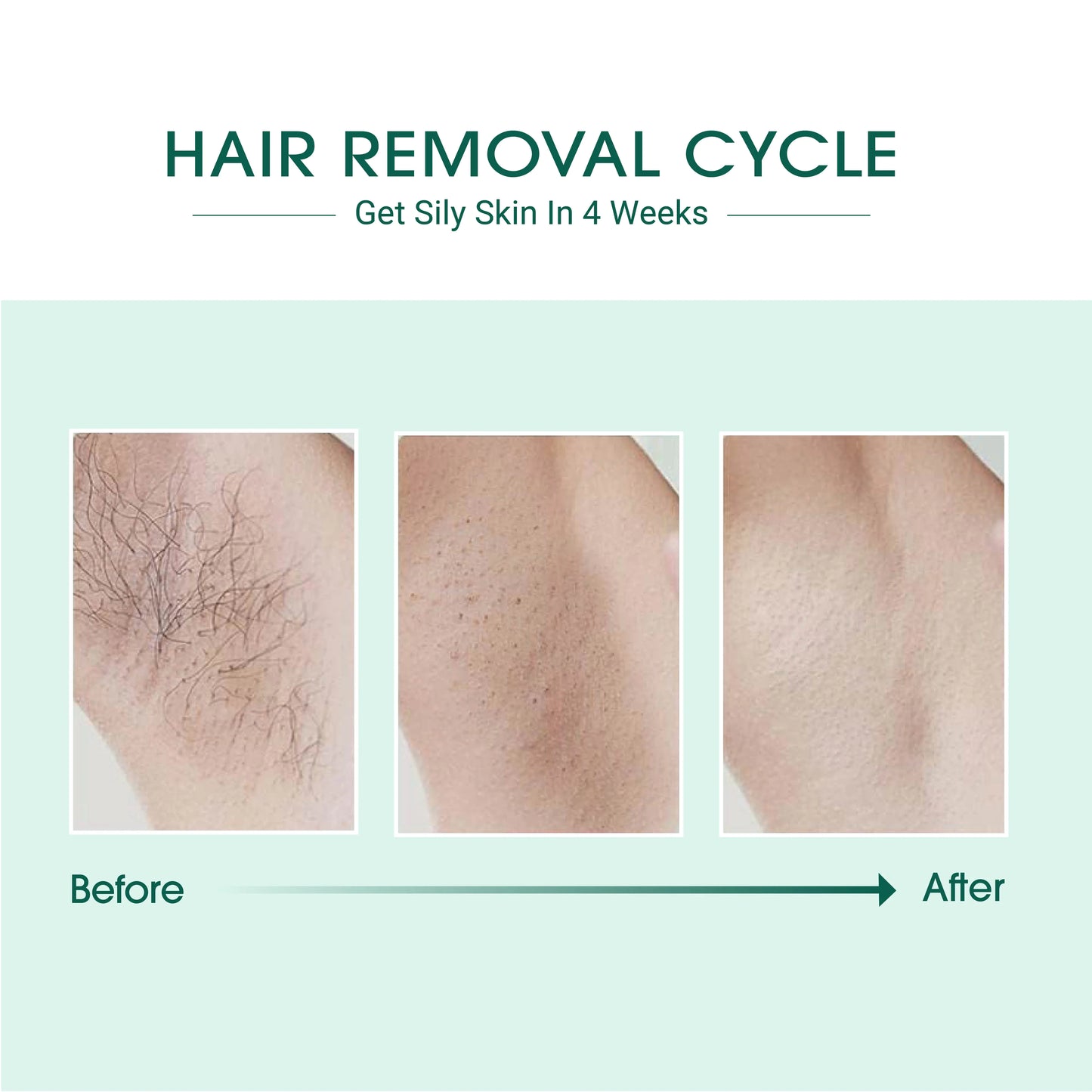 The LumiGlow: Ice-Cooling IPL Hair Removal Handset